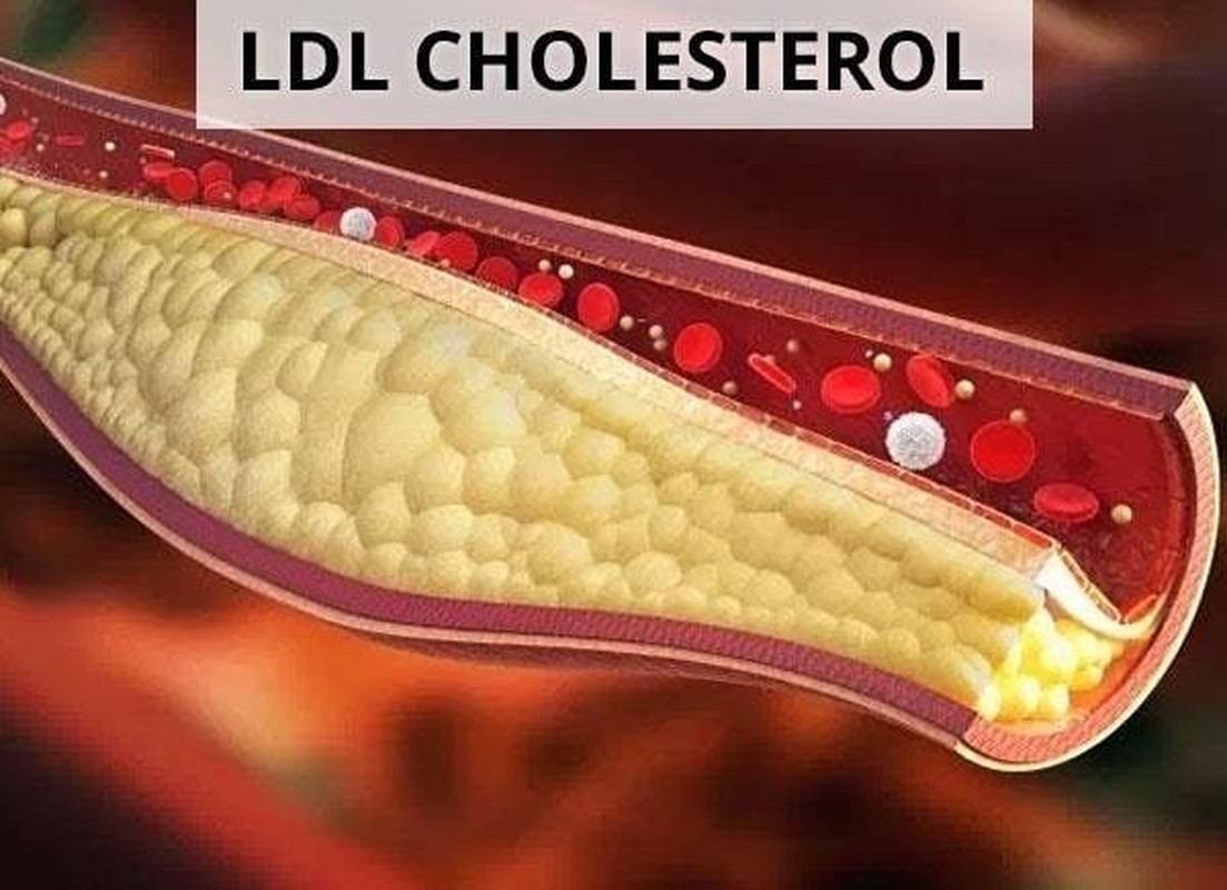 Giật mình thực phẩm tưởng bổ không ngờ giàu cholesterol, nên hạn chế ăn