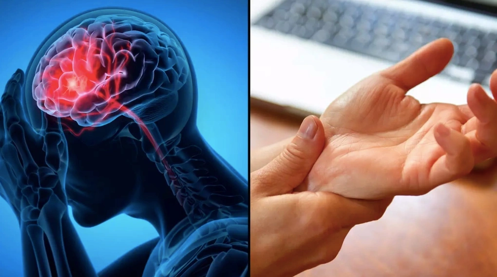 7 dấu hiệu cảnh báo cơn đột quỵ sớm: Biết được cứu nguy kịp thời