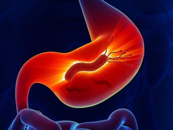 6 dấu hiệu tưởng nhẹ nhưng là “mồi nhử” UT: Đừng chủ quan nếu bạn mắc phải